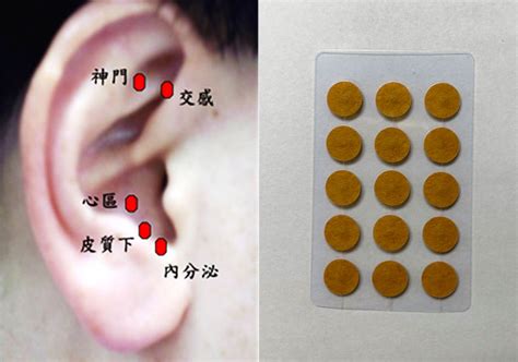 耳穴貼是什麼|為何頭暈、脹氣都要按耳朵？帶你認識中醫「耳穴貼」是什麼！抑。